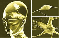 /fotos/futuro/20041113/notas_f/cerebro.jpg